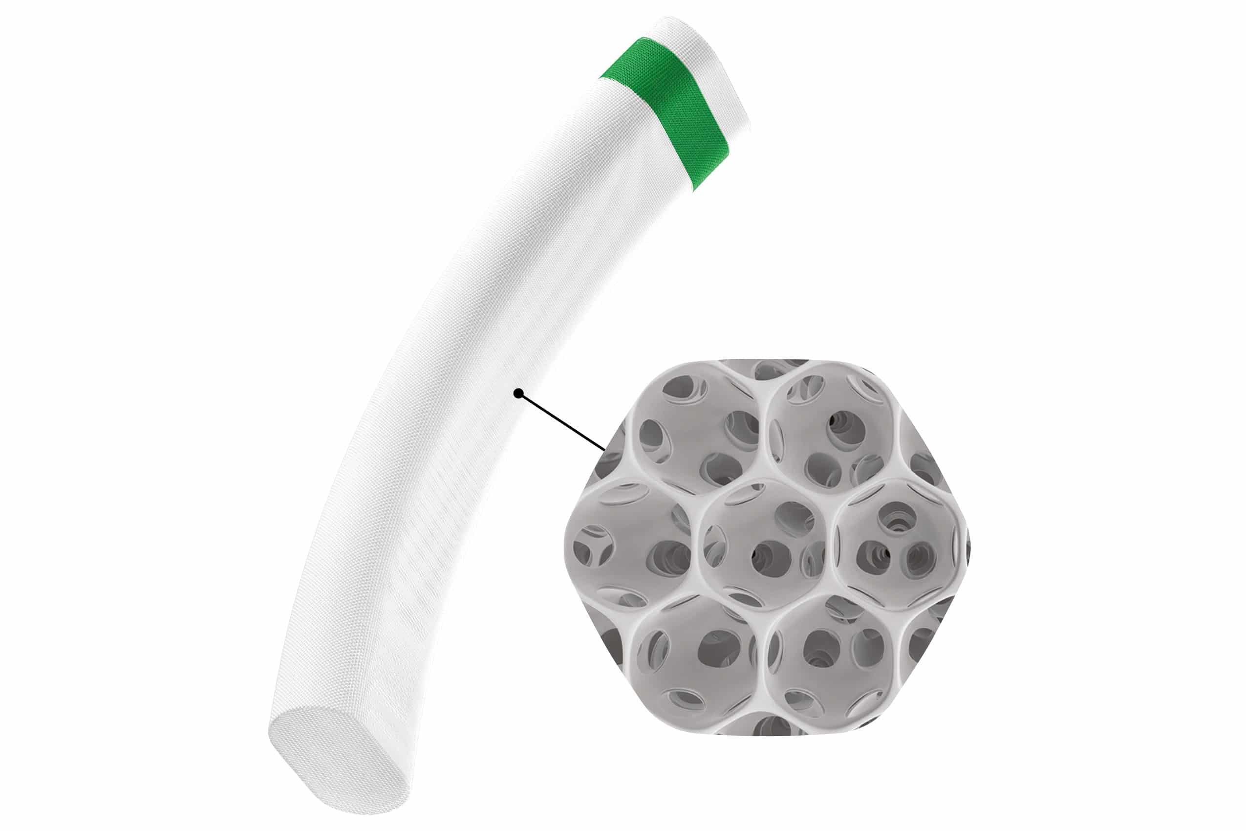MINIject implant with STAR material